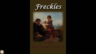 Freckles
