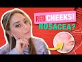 Top 8 Ingredients to Treat Redness & Rosacea from a Dermatologist! | Dr. Shereene Idriss