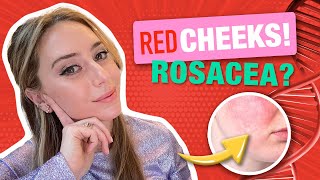 Top 8 Ingredients to Treat Redness & Rosacea from a Dermatologist! | Dr. Shereene Idriss