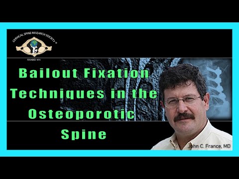 Complications:  Bailout Fixation Techniques in the Osteoporotic Spine- Dr. John C. France