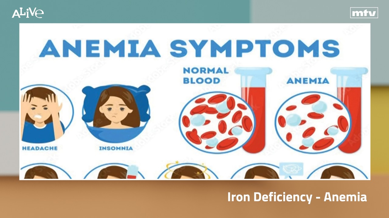 Iron deficiency - Anemia
