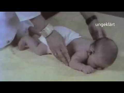 Angeborene Reflexe beim Säugling