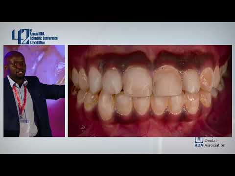 Conservative Dentistry By Dr Godfrey Obaigwa- 42nd ASCE
