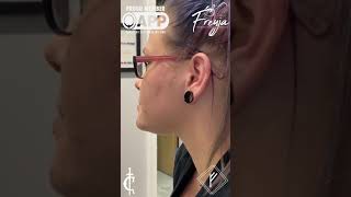 Surface Piercing