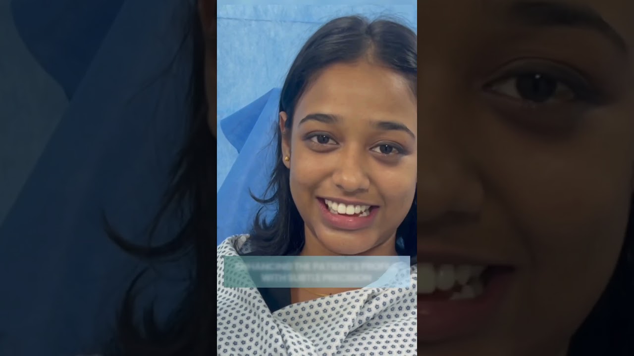 Patient Shares Her Positive Experience with Natural Chin Augmentation done by Dr Rajesh Vasu