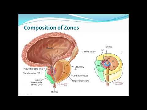 Prostatitis és fogyás