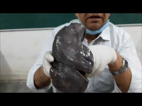 Side Determination and anatomical position of lungs (Demo.)