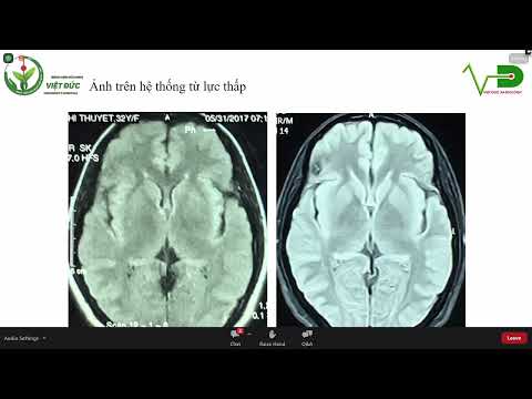 hội thảo thần kinh 11 6