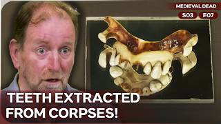 The Dark Trade of 50,000 Teeth Sold in London! | Medieval Dead | Season 3 Episode 7
