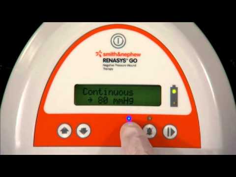 RENASYS◊ GO Functionality Guide