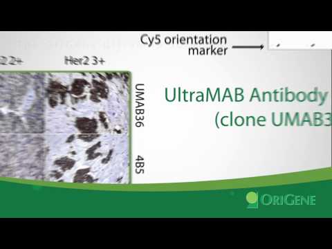 Origene UltraMAB: Ultra-Specific, Application-Validated Antibodies for Cancer Diagnostics