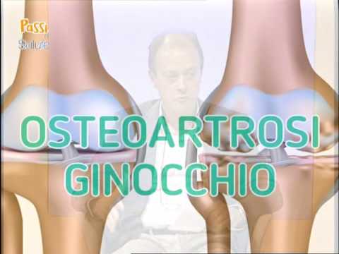 Dolore alle articolazioni e ai muscoli della temperatura Mal di schiena dopo CABG