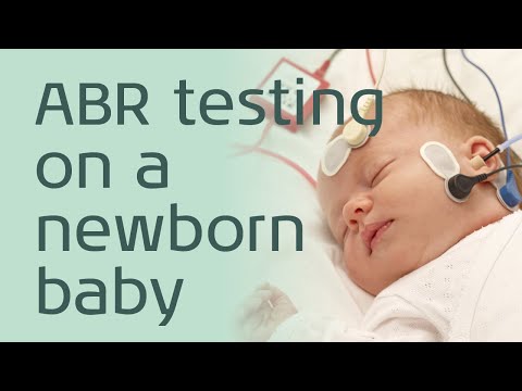 ABR: Testing a newborn baby