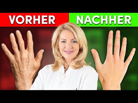 Die Hand-Transformation: Pigmentflecken, trockene und rissige Haut reduzieren