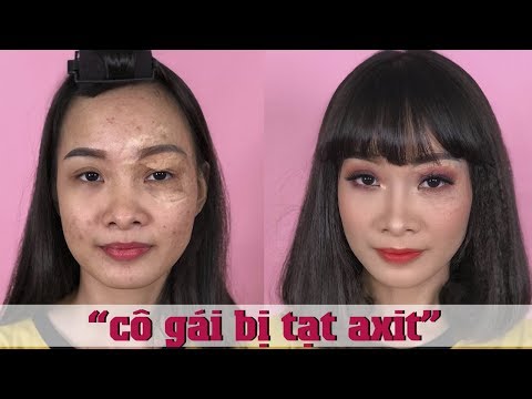 download lagu mp3 mp4 Axit, download mp3 Axit free download mp3, download mp3 Axit