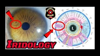 The Only Way To Change Your Eye Color Permanently: How To Take An Iridology Picture Of Your Eye