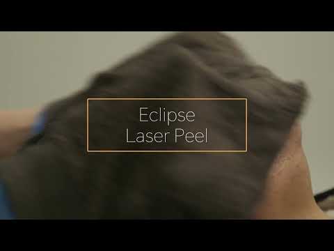 The Eclipse Laser Peel - An Elevated Carbon Facial From Lumiere Medispa in Oxford