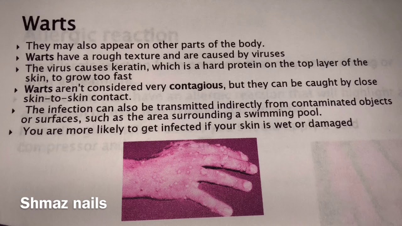 Watch video Information on contra- indications and contra- actions Now Information on contra- indications and contra- actions