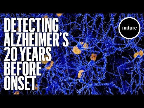 Can Science Detect Alzheimer's Early?