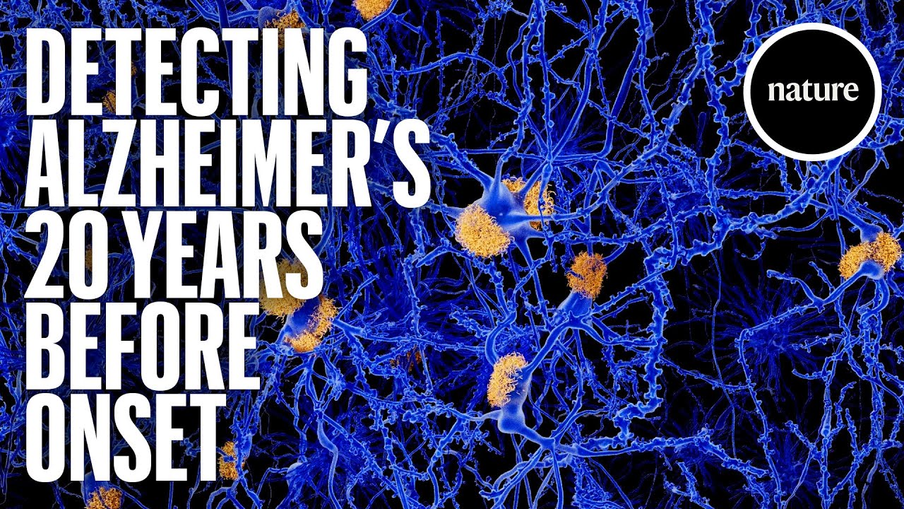 Detecting Alzheimer's 20 years before onset