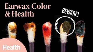 Your Earwax Reveals WHAT About Your Health? Here