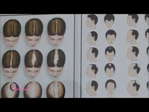 101 HAIR CLINIC ZA LIJEČENJE ISPADANJA KOSE I BOLESTI VLASIŠTA