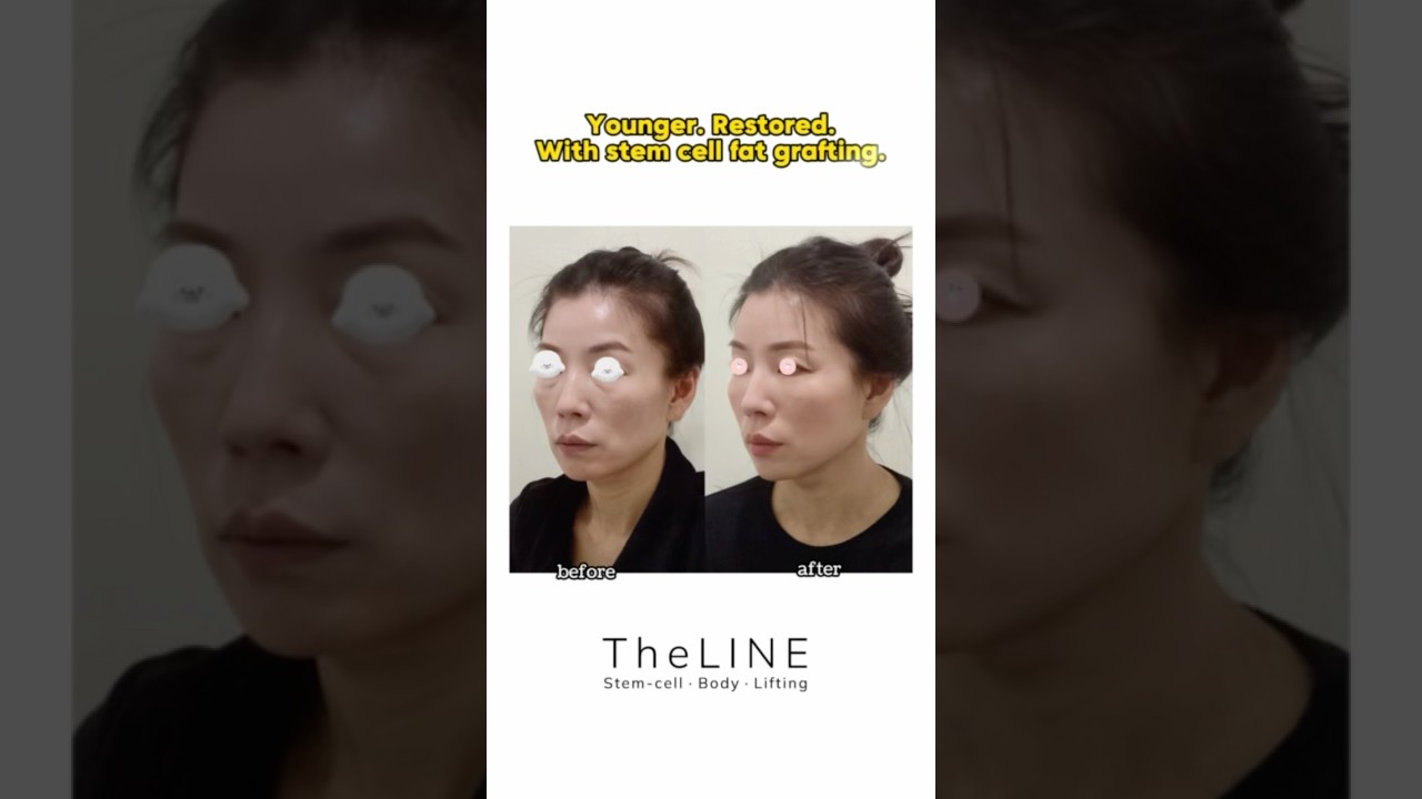 TheLINE shorts video