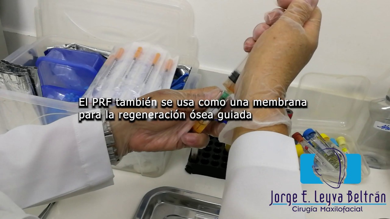 Jorge Eduardo Leyva Beltrán-9