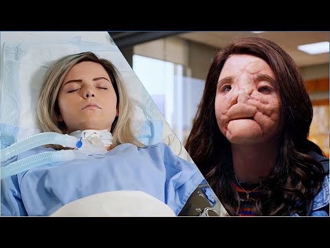 A mother saves another girl using her brain-dead daughter's face |The Good Doctor
