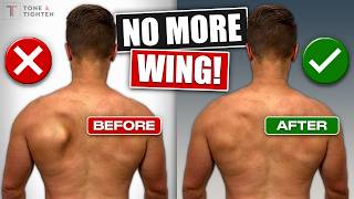 Fix Scapular Winging FOR GOOD! [Shoulder Blade Exercises]