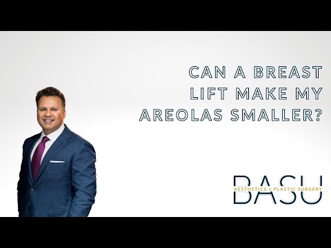 Can the size of my areolas be reduced during a breast lift?