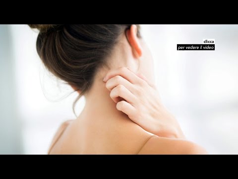 Psoriasi su medicina della pelle principale Se leczema microbico è curabile