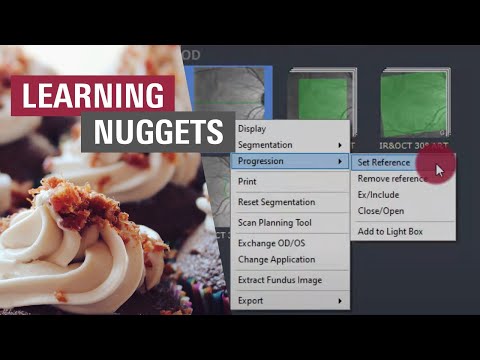 🇩🇪 Retina Verlaufskontrolle – Änderungen erkennen, Referenzen verstehen | SPECTRALIS