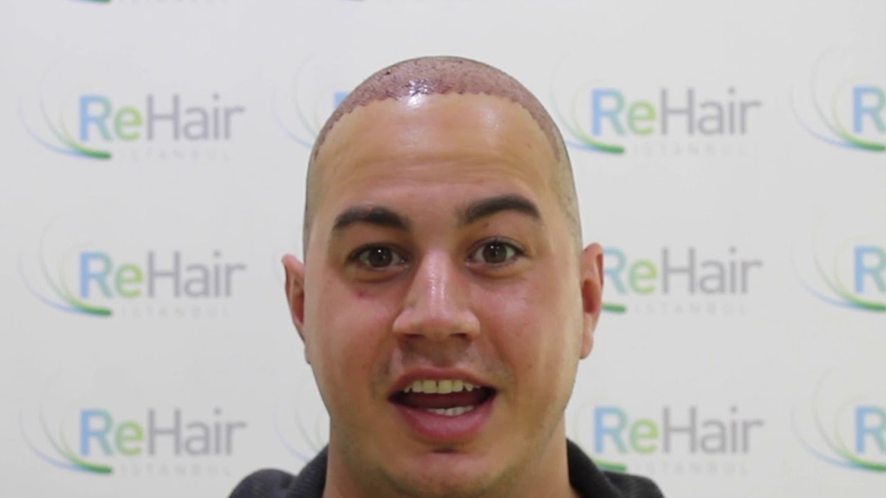 ReHair Istanbul Review - Haartransplantatie in Istanbul, Turkije