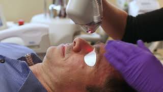 Product video: IPL & Laser Vee-Shields Disposable Eye Protectors