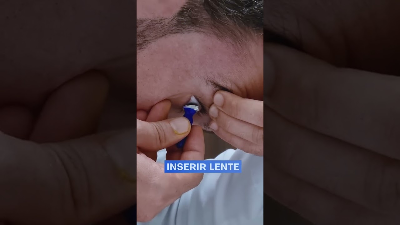 Watch Now Colocando minhas Lentes Esclerais #shorts Colocando minhas Lentes Esclerais #shorts
