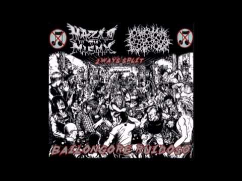 BxPxGx-carcinoma neoplasica renal