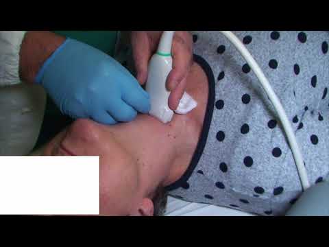 download lagu mp3 mp4 Aspiration Sample, download lagu Aspiration Sample gratis, unduh video klip Aspiration Sample