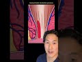 What is a Hemorrhoid and How Do You Treat It? #shorts #hemorrhoids