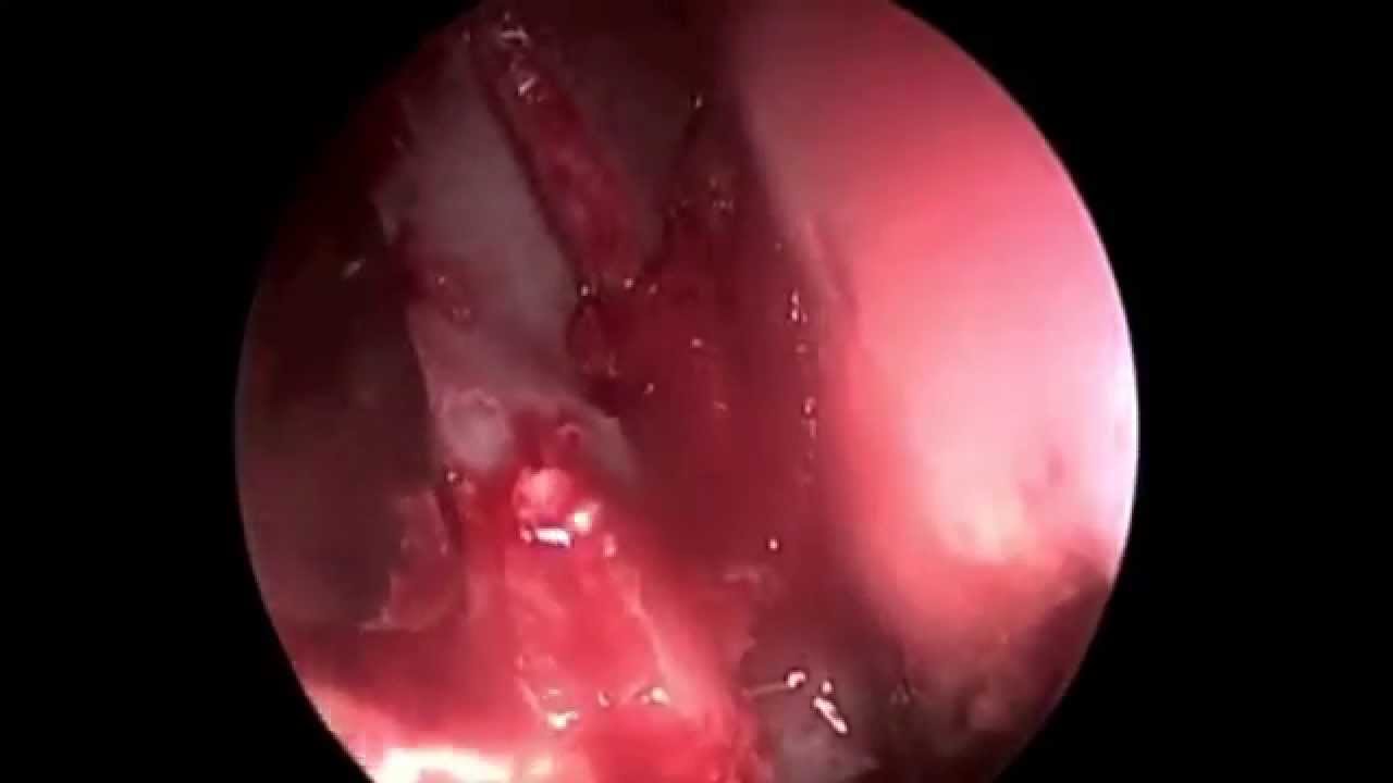 Juan Ramón Benito Navarro-8