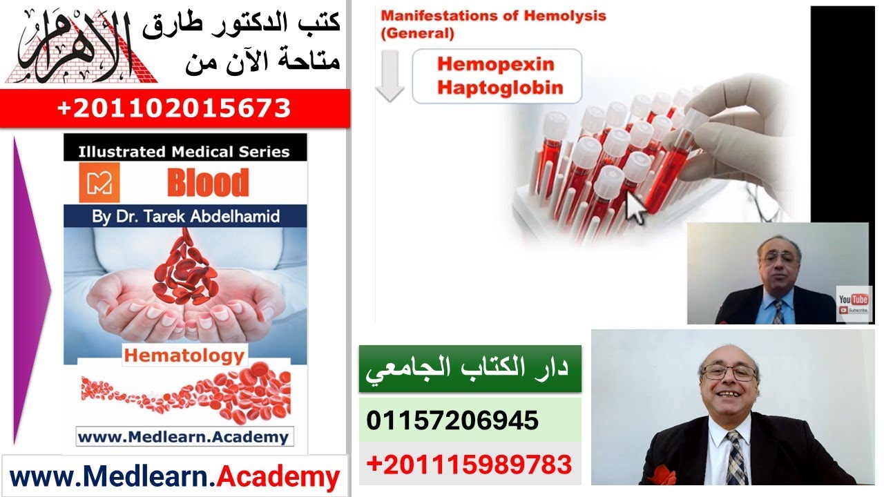 Hemolytic Anemia (General)   #cme #internal_medicine #medical #usmle #محاضرات_باطنة #USMLE