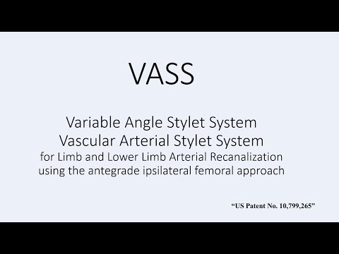 VASS - Variable Angle Stylet System