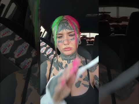 Hand implant #shortvideo