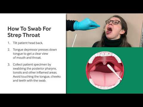 How to Swab for Strep Throat