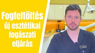 Fogfeltöltés - A csiszolásmentes héj technika