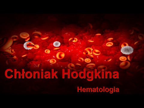 Chłoniak Hodgkina
