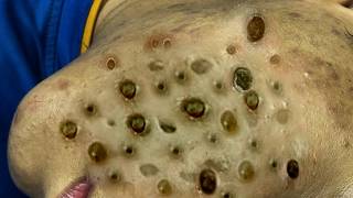 𝐑𝐞𝐟𝐫𝐞𝐬𝐡 𝐘𝐨𝐮𝐫 𝐅𝐚𝐜𝐞 𝐖𝐢𝐭𝐡 LNG 𝐒𝐤𝐢𝐧 𝐂𝐚𝐫𝐞 #