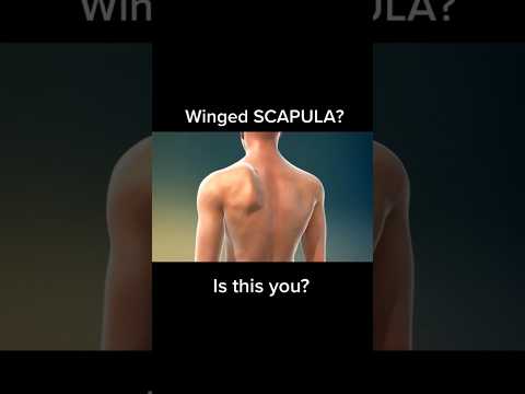 How to Fix Scapular Winging - Quick #calisthenics