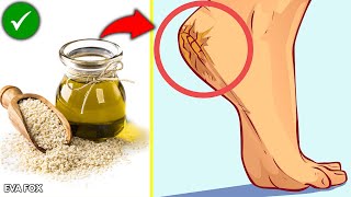 Never worry about dry and cracked or itchy feet again with these home remedies