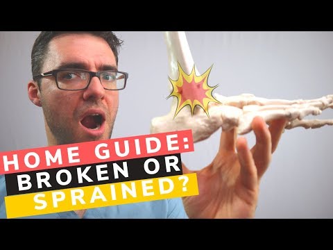 BEST 25 Plantar Fasciitis HOME Treatments Massage Stretches Shoes